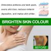 50ml Crema Aclaradora Para Piel Manchas En Cara Axilas Cuello Entrepierna, Crema Para Aclarar Las Axilas Y Partes Intimas, Intimate Bleaching Cream for Women, crema Blanqueadora Para Partes Intimas view 2