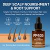 PP405 Hair Treatment Dropper Oil - for Men & Women Thinning & Receding Hair, Nourishes Scalp - 30ML view 4