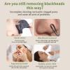 Blackhead Remover Tools, Face Spatula Skin Scrubber Nose Blackhead Remover Pore Cleaner Facial Deep Cleansing Tool Skin Care Tool for Men and Women view 4