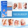 Extra Strength Nail Repair Pen, 4 Nail Oil Cuticle Pens With Natural Plant Extracts for Repairing Discolored, Broken & Damaged Toenails, Effective Nail Repair Solution view 4