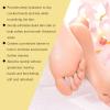Crack Feet Prevention Stick, Heel Cream For Dry Cracked Feet, Foot Care Cream Moisturizing Foot Balm, Remove Dead Skin And Softening Dry Skin (Green Apple*2) view 3