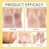 Crack Feet Prevention Stick, Heel Cream For Dry Cracked Feet, Foot Care Cream Moisturizing Foot Balm, Remove Dead Skin And Softening Dry Skin (Green Apple*2) view 4