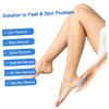 VICASKY 6pcs Multifunctional Double Sided Pumice Stone Foot File Pedicure Brush for Dead Skin Removal and Callus Scraping Lightweight Foot Beauty Tool with Massage Effect Random Color view 4