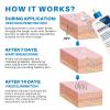 Oveallgo NanoLipo Warts Eraser Cream, Professional Warts Relief Cream, Mens GentX Relief cream - Soothing Intimate Skin - 50G (2) view 3