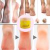 Exfoliante de pies La Niquerea - Foot Exfoliating Gel for Dry and Cracked Heels  Deep Moisturizing Dead Skin Remover  Softens and Smooths Feet view 3