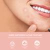 AVJONE Pimple Patches for Face, Hydrocolloid Acne Patches with Tea Tree Oil, pimple stickers for Breakouts, Absorbs Zits, Invisible Spot Cover and Blemish -(144 Patches) view 2