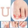 DeaHea 40 Pack Ingrown Toenail Treatment Corrector Patch U-Shaped Toenail Corrector Strips Correction Patches Bandages for Ingrown Toenail Relief Drops Softener Tool Pedicure Removal Kit view 3