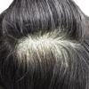 Hair Wonders Mens Toupee Human Hair Pieces Systems for Men Hairpieces Fine Welded Lace Hair System Toupee for Men Replacement Natural Breathable 8X10#1B30 Off Black+30% Grey 90% Density view 4