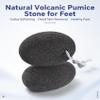 Rolabling Natural Pumice Stone for Feet & Hands Lava Rock Callus Remover, Deep Exfoliator for Dry Cracked Heels, Dead Skin & Hard Skin Pedicure Tool for Smooth Soft Feet view 2