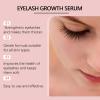 Daily Gentle Eyelash Serum - Enhances Lash Appearance, Nourishes Deeply, Natural Long-Lasting Look, Promotes Healthy Lashes(2PCS) view 3