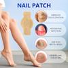 Nail Patches, 8-Hour Overnight Treatment, Fast-Acting Toenail Repair Patches, 21 Patch,for Damaged Nails Foot Nails Repair and Care,Strengthens Brittle Nail (21 Patch*2) view 3