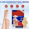 Nail Patches, 8-Hour Overnight Treatment, Fast-Acting Toenail Repair Patches, 21 Patch,for Damaged Nails Foot Nails Repair and Care,Strengthens Brittle Nail (21 Patch*2) view 4