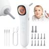 Otoscope Ear Camera with 1.21 Screen, 1080P Ear Scope with 4 LED Lights, Otoscope Camera for Adults Kids and Pets, Support Photo & Video, Type-C Charging with Computers, Baby Essentials, Home Medical view 1