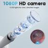 Otoscope Ear Camera with 1.21 Screen, 1080P Ear Scope with 4 LED Lights, Otoscope Camera for Adults Kids and Pets, Support Photo & Video, Type-C Charging with Computers, Baby Essentials, Home Medical view 4