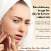 LE GUSHE Korean Pimple Patches & Face Balm Stick Bundle - 132 Dots Pimple Patches with All-in-One Face Balm Stick view 3