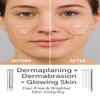 KmaxShip 2-in-1 Dermaplaning Tool Ultra+ for Women Face, Facial Hair Remover with 4 Microsmooth Exfoliation Tips & 12 Dermaplaning Blades, Peach Fuzz Remover Razor & Face Exfoliator view 4