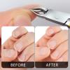 Criyar Cuticle Nippers Kit: Precision Nano-Coated Stainless Steel Cuticle Trimmer Remover for Fingernails and Toenails, Cutter for Manicure Pedicure, Nail Clippers Tools for Women (Gold+Red 2PCS) view 4