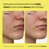 Peach Slices - Super Fade Discoloration Serum for Face (1.01 oz) - Dark Spots, Hyperpigmentation, Uneven Skin - Niacinamide Serum - Tranexamic Acid - Vegan & Cruelty Free - Korean Skin Care & Beauty view 4