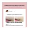 Handheld Ice Point Hair Removal Device view 4