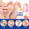 2Pcs Crack Feet Prevention Stick, Hydrating Heel Balm for Dry Cracked Feet,Moisturizing Foot Care Cream, Foot Balm Stick Intensive Repair Feets,Hands,Heels,Elbow and Knees and Softening Dry Skin view 3