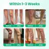 Balanlogy Vein Soothing Spray, Professional Varicose Veins Treatment for Legs Spray, Timilk Vein Guard Herbal Spray-30g, Natural Ingredients Leg Treatment for All Skin Types (2 Bottle) view 3