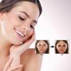 Elitzia CO Facial Kit - 6 Sets/Box for CO Oxygen Facial Machine, Oily Skin Regulation & Texture Improvement ETDGEL7 (Regulating Formula) view 3