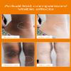 Gneric Crema Para Manchas Oscuras En La Cara 5pcs, crema Para Las Manchas De La Cara, Para Piel Entrepierna, Manchas Codos, Piernas Zonas,Rodillas Cuello view 3