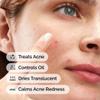 The Ordinary Sulfur 10% Powder-to-Cream Acne Spot Treatment Concentrate, Reduces Pimple Size and Zit Redness, 0.18 Oz view 2