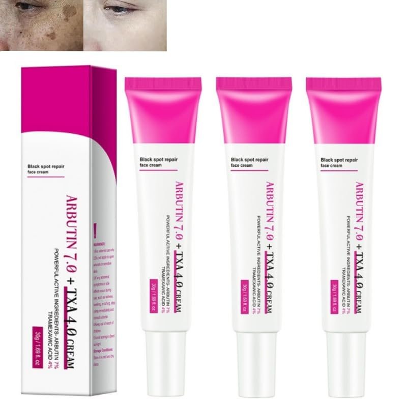 3PCS*30G Crema para Manchas en La Cara, Cremas para la manchas de la cara,crema para aclarar la piel,Face Moisturizing cream