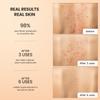 BellamiLuxx Body Acne Treatment Scrub: Helps Reduce Body Breakouts on Back, Chest, Butt & Thighs - Back Acne Treatment for Men, Women & Teens - Butt Acne Wash with Natural Actives for Smooth Skin view 3