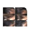 Cecred - Restoring Hair & Edge Drops - Daily Peptide Serum for Fuller-Looking Hair, Supports Hairline & Scalp Health, Strengthens Roots, Size:(1.7 fl oz) view 3