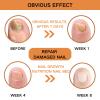 2Pcs Bee Venom Nail Soothing Spray, Toe Nail Treatments Spray for Damaged Nails, Advanced Nail Care Solution, Safely and Gently for All view 3