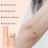 Scar Solutions Silicone Scar Stick, 60% Silicone Scar Stick for Face & Body, Easy Application, Contains 60% Silicones (3Pcs) view 3