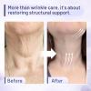 ZZILME Premium Neck Creams For Tightening and Firming  Lifting Treatment for Dcollet and Chest, Anti-Aging Neck Cream Reduces Fine Lines and Sagging, Gift for Women & Men, 2.03 Fl Oz view 2