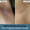 BA.K.E.. Anti-Pigmentation Soap with 2% Kojic Acid and Alpha Arbutin, 200 gm / 6.76 Fl Oz, Pack of 2 view 3