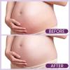 Stretch Mark Belly Butter-Packed with Vitamin E, Coconut Oil, and Sunflower Seed Oil to Protect, Soothe, and Rejuvenate Skin - Safe for Pregnancy and Nursing-Repair Stretch Marks and Scars.7.055oz view 4