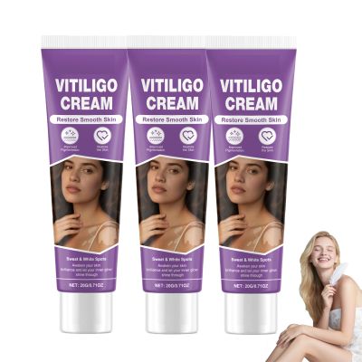 Vitiligo Cream, Vitiligo Treatment Cream Reduce White SpotsEasy to Use