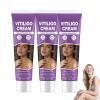 Vitiligo Cream, Vitiligo Treatment Cream Reduce White SpotsEasy to Use view 1