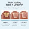 MyNuNail Nail Care/Conditioning Pen  Botanical Oils for Healthy, Clear-Looking Toenails and Fingernails  Fast Precision Brush Application Nail Repair Pen, Appearance of Clear Nails - Pack of 6 view 3