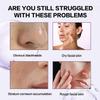 Rice Peeling Ampoule, Soft Exfoliating, Dead Skin and Blackheads Remover, Moisturizing, Travel-Friendly For All Skin Types view 3