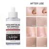 Rice Peeling Ampoule, Soft Exfoliating, Dead Skin and Blackheads Remover, Moisturizing, Travel-Friendly For All Skin Types view 4