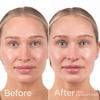 EltaMD UV Daily Hydration+ SPF 50, Dermatologist Trusted Lightweight Hybrid Sunscreen Providing Advanced Sun Protection and Corrective Skin Hydration. view 4