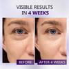 Eye Serum for Dark Circles and Puffiness, Caffeine Eye Serum Infused Collagen and Niacinamide with Ice Globe for Puffy Eyes Treatment for Women view 2