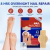 Toenail Treatment Extra Strength - Nighttime Nail Patches,Overnight Toe Nail Treatments for Damaged Nails Foot Nails Repair and Care (42Pcs) view 2