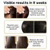 FLEXQW 1 PCS 300ML Anti-Hair Fall Promote Hair Growth Shampoo for Women Men Hair Loss,Rich in Various Plant Extracts Shampoo for all Type. view 3