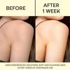 Anti Tan Face & Body Scrub, 250ml, with Jojoba Oil, for Blackhead Removal view 3