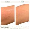 ELASCO RESC-U Spray Hypochlorous Acid Spray for FACE and Body view 4