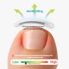 KmaxShip Kids Ingrown Toenail Corrector, Gentle & Safe Ingrown Toenail Treatment for Children, At-Home Solution for Kids Ingrown & Curved Nails, Comfortable Lift for Delicate Nails (0.39 Inch) view 4