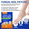 Toenail Treatment Extra Strength - 32 Pcs Nighttime Nail Patches, Overnight Toe Nail Treatments for Damaged Nails Foot Nails Repair and Care, 8-Hour Restores Healthy Appearance (2PCS) view 3