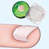 20Pcs Ingrown Toenail Correction Strips Brace Kit, Ingrown Toenail Corrector Straightener Strips Recover Clips Toenails Thick Pedicure Tool Toenail Straightener Strip for Men Women Foot Care Tool view 2